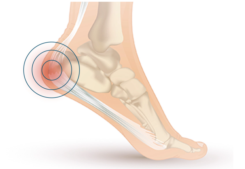 pain inside foot arch