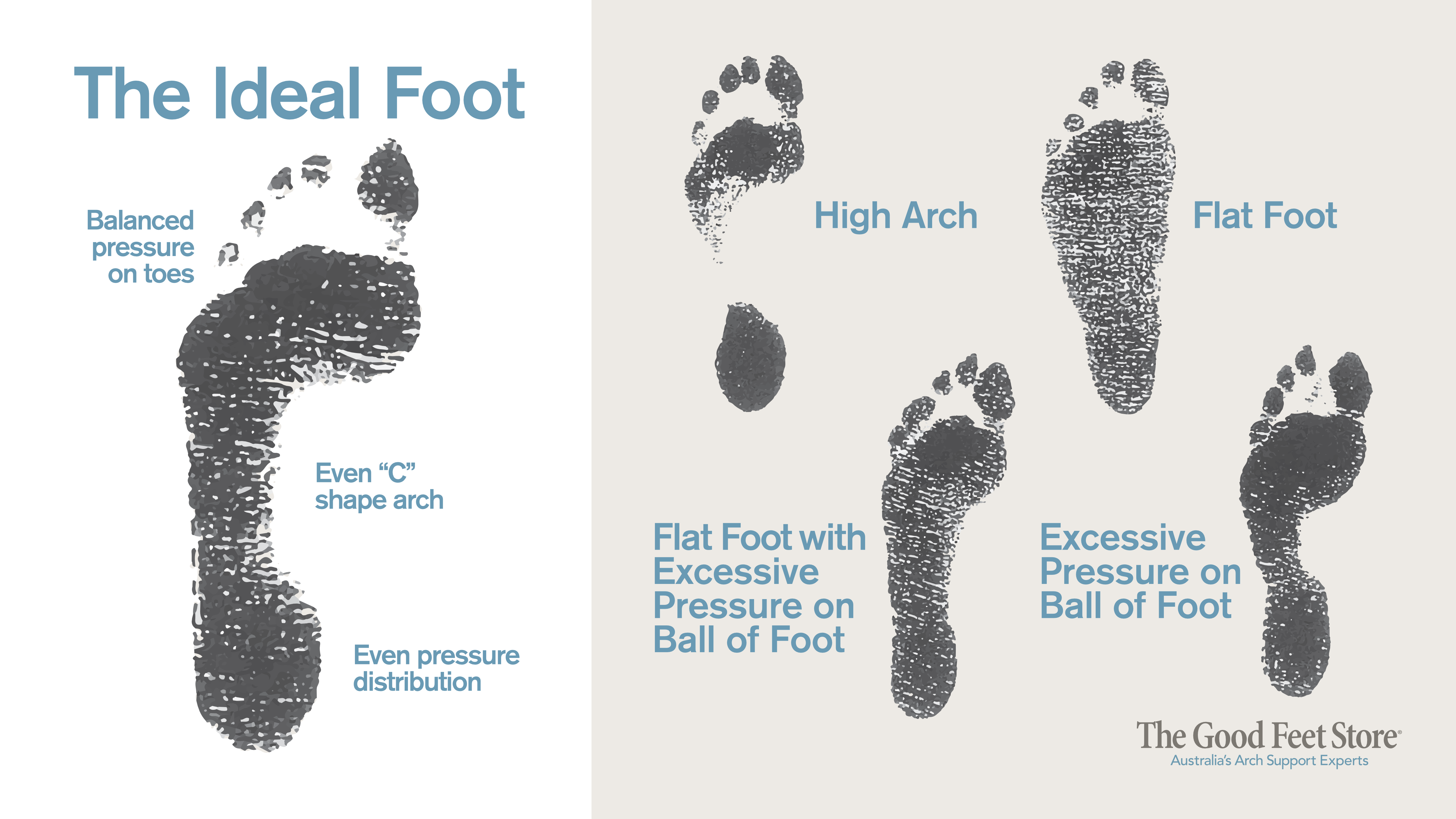 Diagram of ideal foot structure and different foot types with labels.